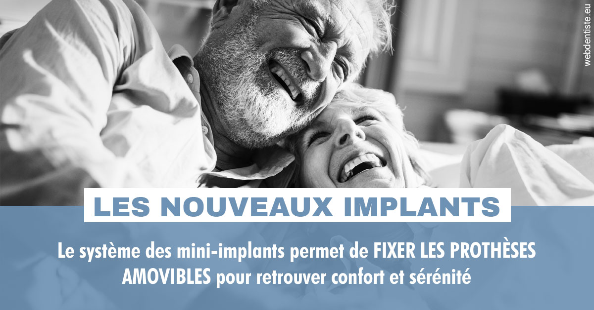 https://dr-jeannenot-luc.chirurgiens-dentistes.fr/Les nouveaux implants 2