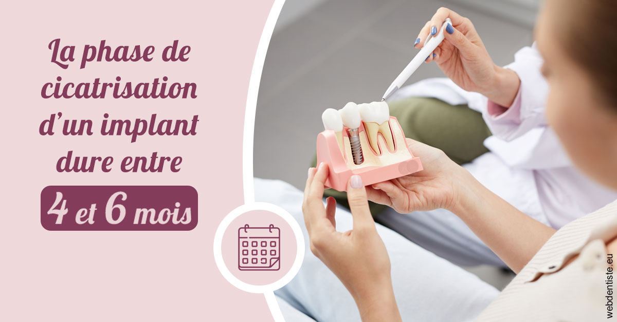 https://dr-jeannenot-luc.chirurgiens-dentistes.fr/Cicatrisation implant 2