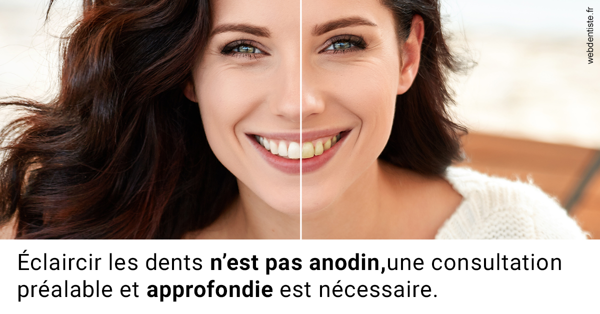 https://dr-jeannenot-luc.chirurgiens-dentistes.fr/Le blanchiment 2