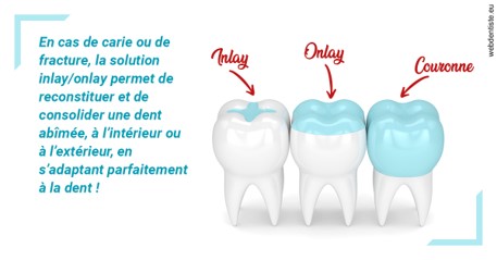 https://dr-jeannenot-luc.chirurgiens-dentistes.fr/L'INLAY ou l'ONLAY