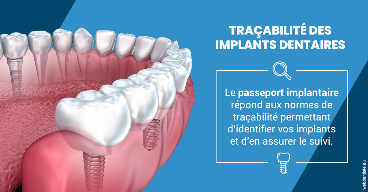https://dr-jeannenot-luc.chirurgiens-dentistes.fr/T2 2023 - Traçabilité des implants 1