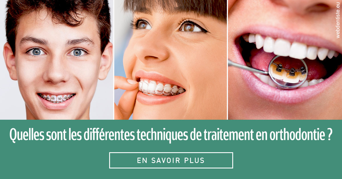 https://dr-jeannenot-luc.chirurgiens-dentistes.fr/Les différentes techniques de traitement 2