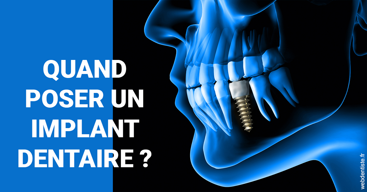 https://dr-jeannenot-luc.chirurgiens-dentistes.fr/Les implants 1