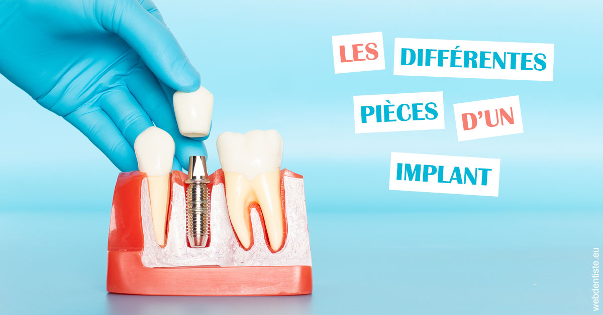 https://dr-jeannenot-luc.chirurgiens-dentistes.fr/Les différentes pièces d’un implant 2