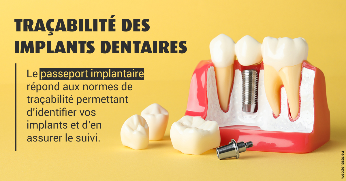 https://dr-jeannenot-luc.chirurgiens-dentistes.fr/T2 2023 - Traçabilité des implants 2
