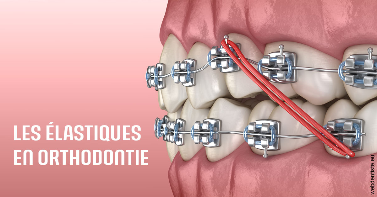 https://dr-jeannenot-luc.chirurgiens-dentistes.fr/Elastiques orthodontie 2