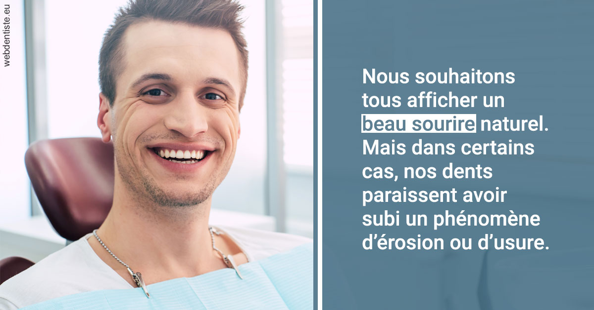 https://dr-jeannenot-luc.chirurgiens-dentistes.fr/Érosion et usure dentaire