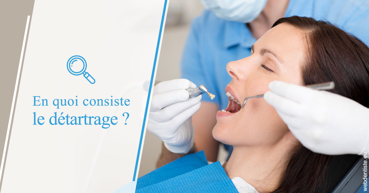 https://dr-jeannenot-luc.chirurgiens-dentistes.fr/En quoi consiste le détartrage